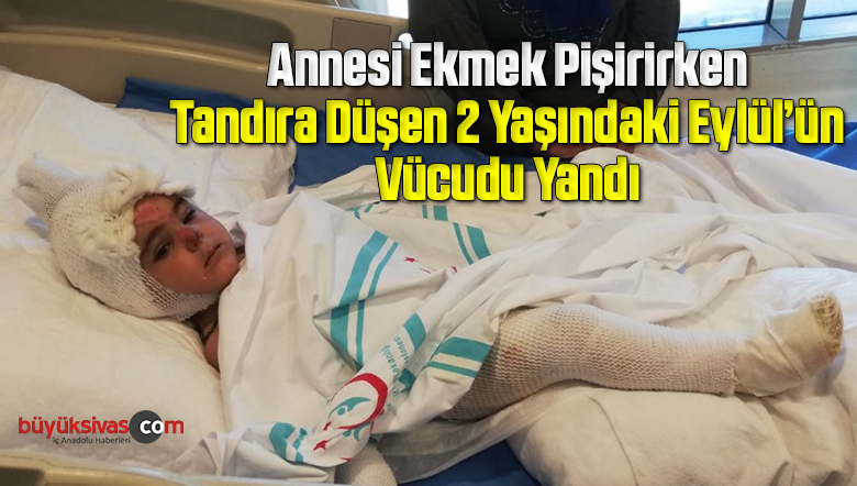 Tandıra düşen 2 yaşındaki çocuğun vücudu yandı