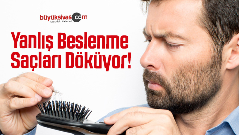 Yanlış Beslenme Saçları Döküyor!