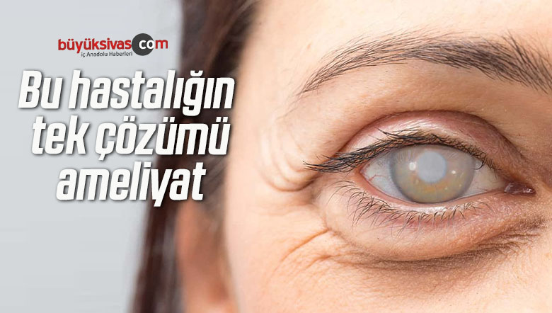 Bu hastalığın tek çözümü ameliyat