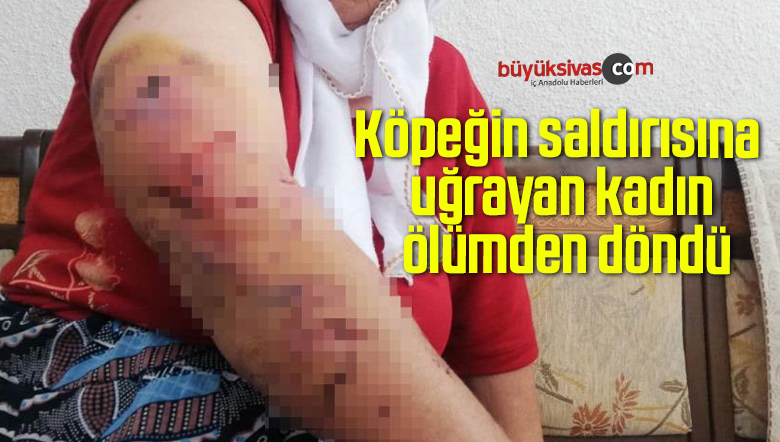 Köpeğin saldırısına uğrayan kadın ölümden döndü