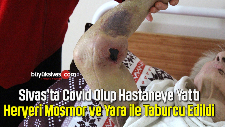 92 yaşında Covid-19’u yense de vücudunda oluşan yaralar tedirgin etti