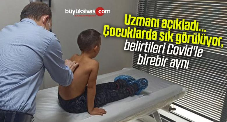 Uzmanı açıkladı…Çocuklarda sık görülüyor, belirtileri Covid’le birebir aynı