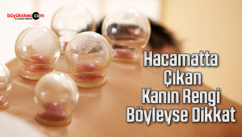 Hacamatta Çıkan Kanın Rengi Böyleyse Dikkat