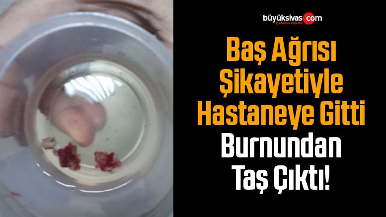 burun taşı