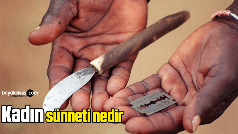 kadın sünneti