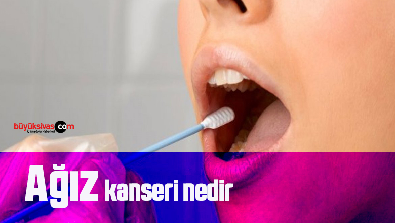 Ağız kanseri nedir