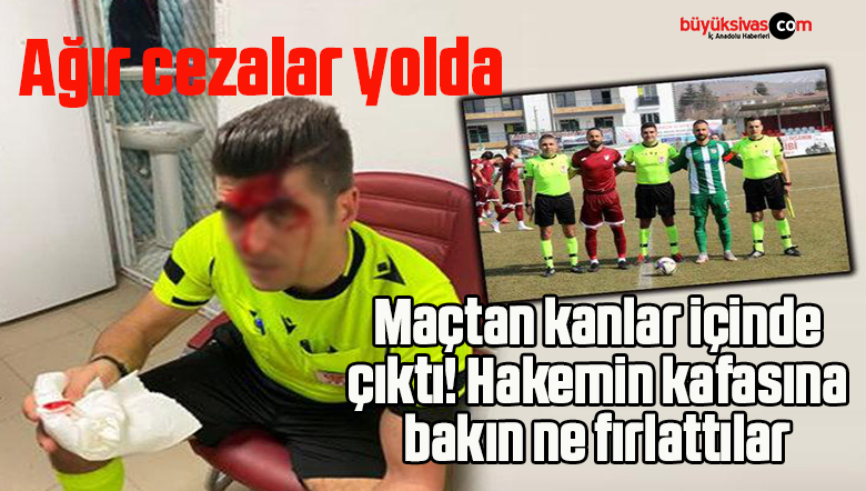 Ağır cezalar yolda!Maçtan kanlar içinde çıktı! Hakemin kafasına bakın ne fırlattılar