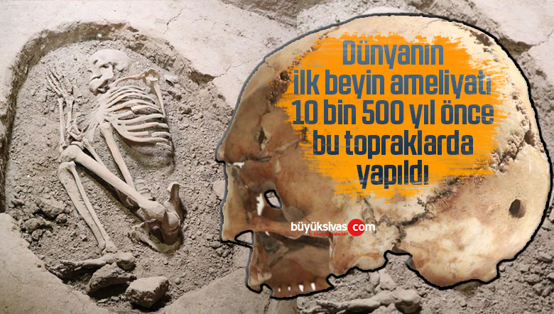Dünyanın ilk beyin ameliyatı 10 bin 500 yıl önce bu topraklarda yapıldı