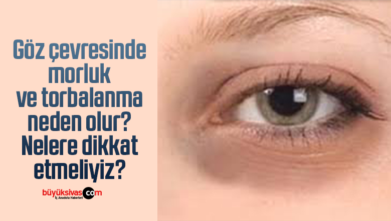 gö çevresinde morluk