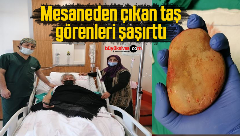 mesaneden çıkan taş