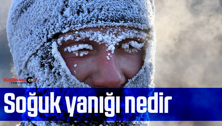 soğuk