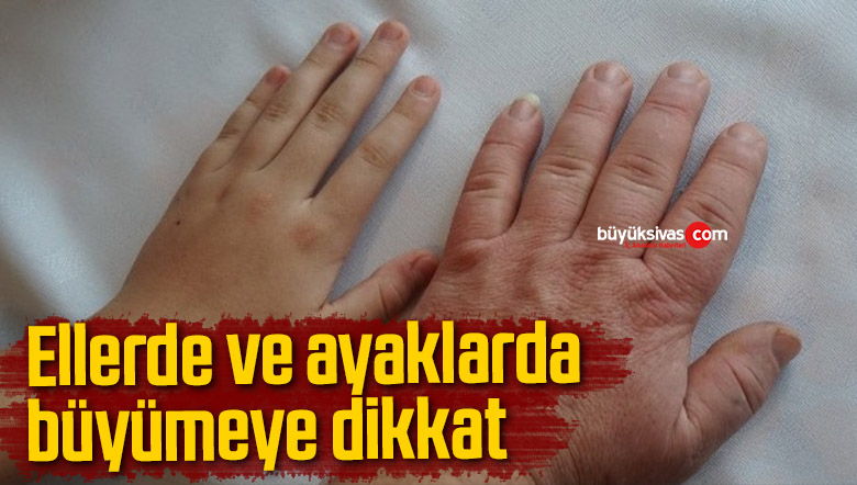 eller ve ayaklar