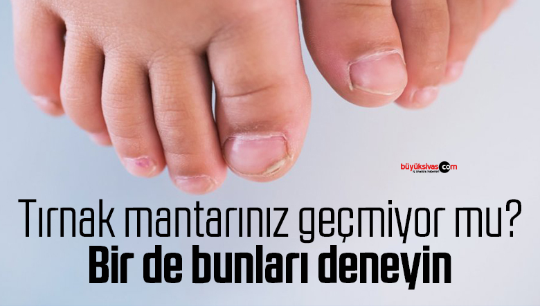 tırnak mantarı