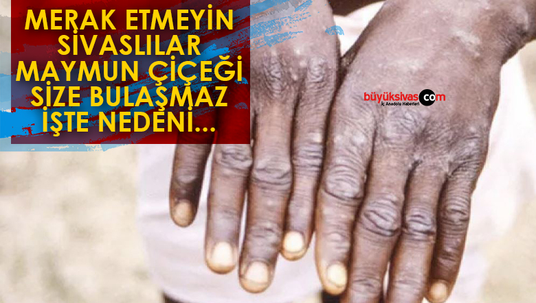 MAYMUN ÇİŞEÇĞİ