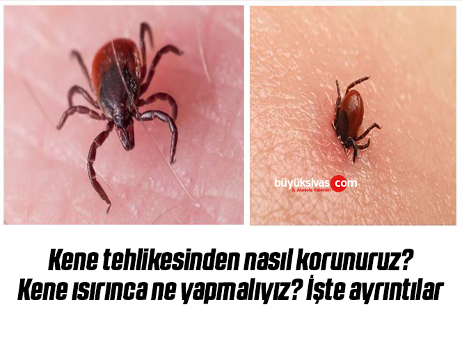 kene ısırınca