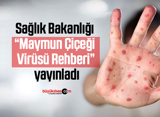 Sağlık Bakanlığı “Maymun Çiçeği Virüsü Rehberi” yayınladı