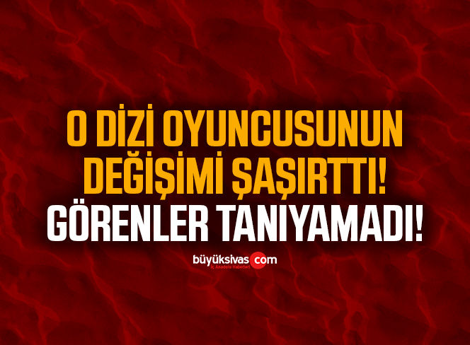 O dizi oyuncusunun değişimi görenleri şaşırttı!