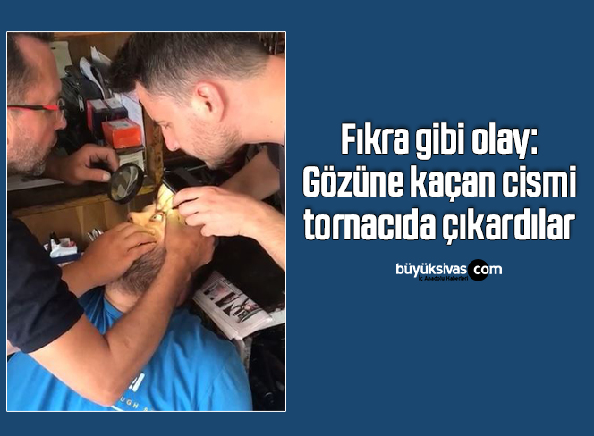 Fıkra gibi olay: Gözüne kaçan cismi tornacıda çıkardılar