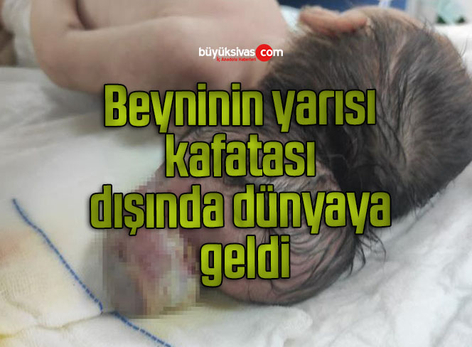 kafa