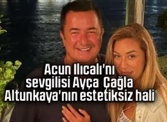 Acun Ilıcalı’nın sevgilisi Ayça Çağla Altunkaya’nın estetiksiz hali
