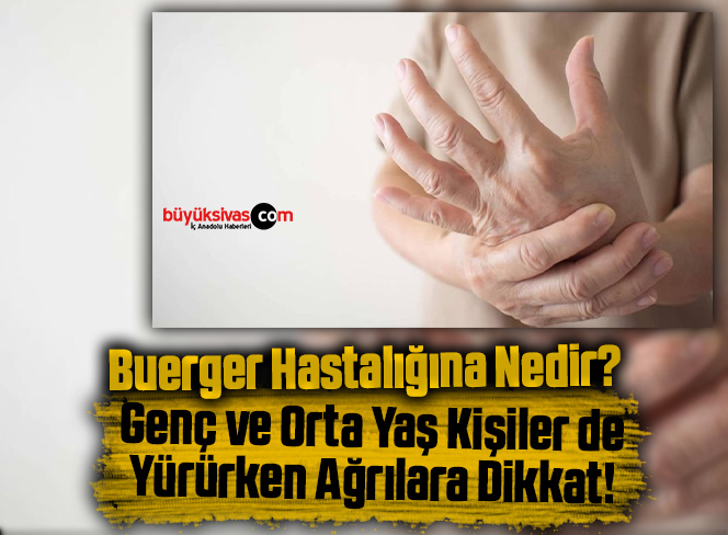 buerger