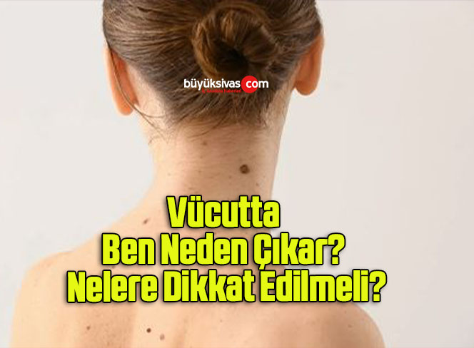 Vücutta Ben Neden Çıkar? Nelere Dikkat Edilmeli?