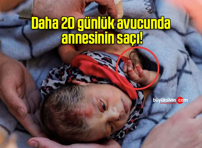saç