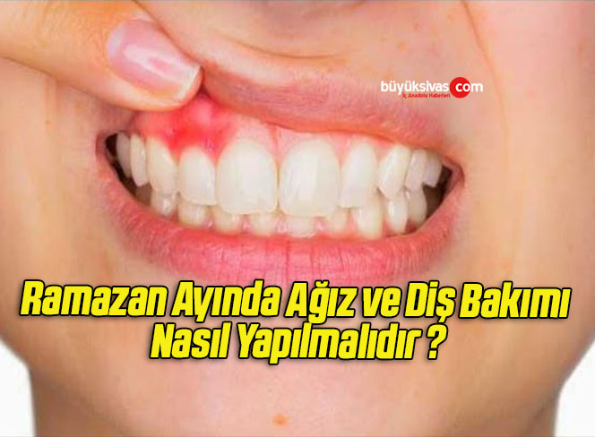 Ramazan Ayında Ağız ve Diş Bakımı Nasıl Yapılmalıdır ?