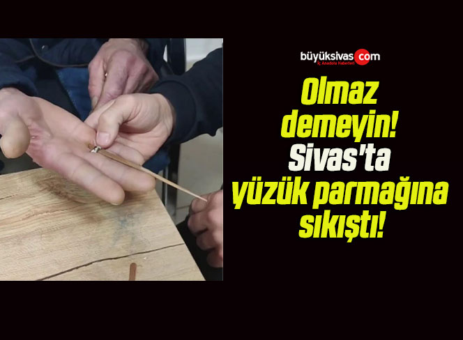 Olmaz demeyin! Sivas’ta yüzük parmağına sıkıştı!