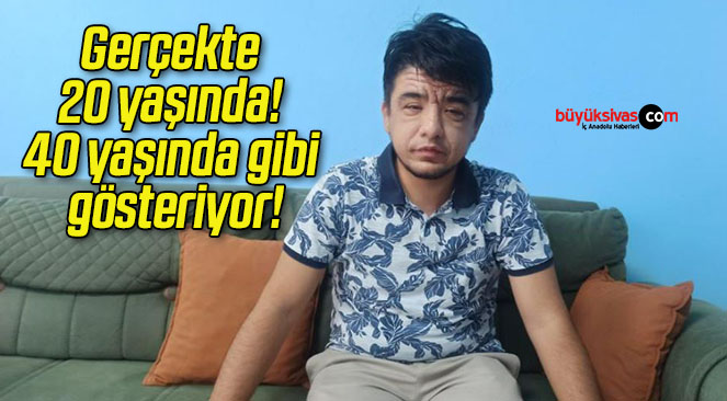 Gerçekte 20 yaşında! 40 yaşında gibi gösteriyor!