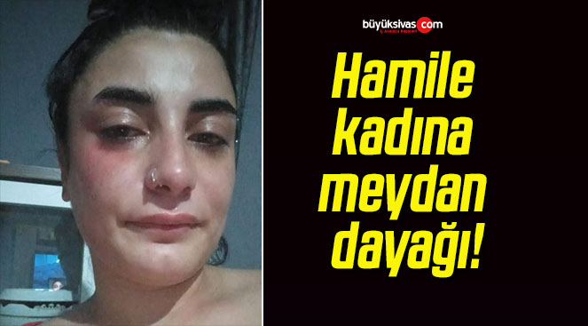 Hamile kadına meydan dayağı!