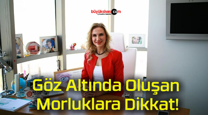 Göz Altında Oluşan Morluklara Dikkat!