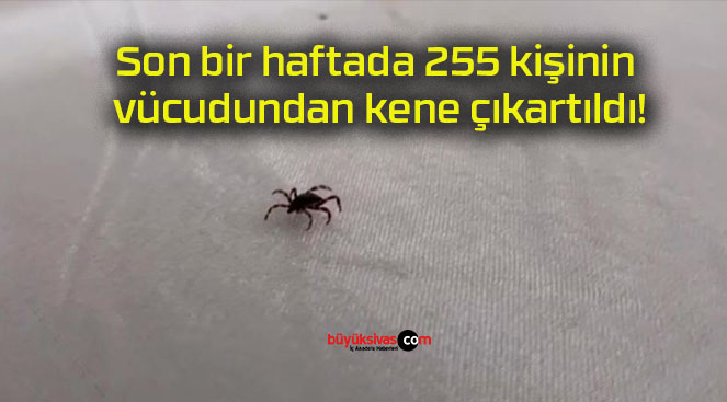 Son bir haftada 255 kişinin vücudundan kene çıkartıldı!