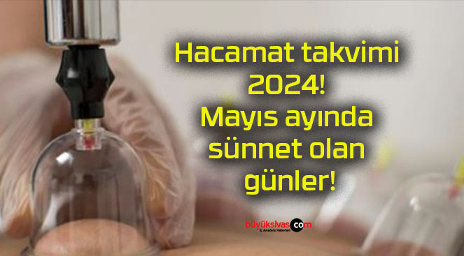 Hacamat takvimi 2024! Mayıs ayında sünnet olan günler!