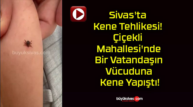 Sivas’ta Kene Tehlikesi! Çiçekli Mahallesi’nde Bir Vatandaşın Vücuduna Kene Yapıştı!