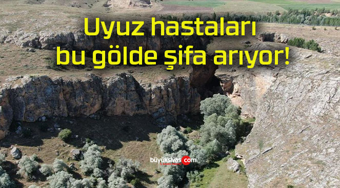 Uyuz hastaları bu gölde şifa arıyor!