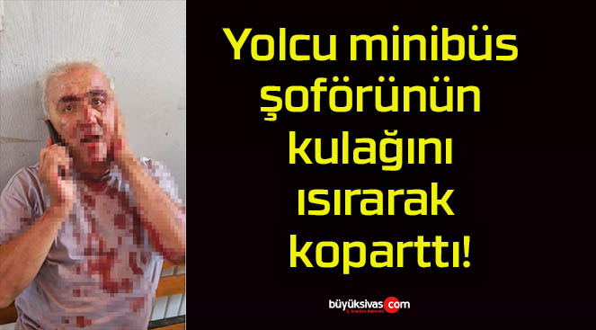 Yolcu minibüs şoförünün kulağını ısırarak koparttı!
