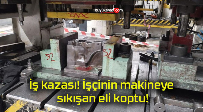 İş kazası! İşçinin makineye sıkışan eli koptu!