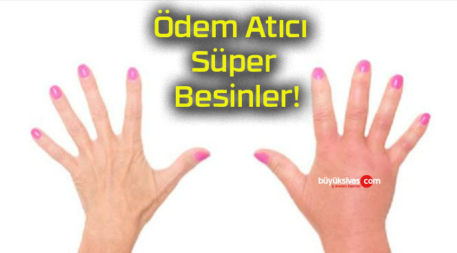 Ödem Atıcı Süper Besinler!
