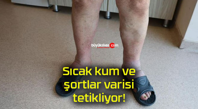 Sıcak kum ve şortlar varisi tetikliyor!