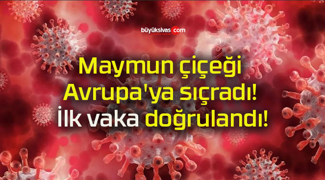 Maymun çiçeği Avrupa’ya sıçradı! İlk vaka doğrulandı!