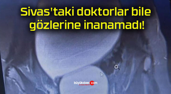 Sivas’taki doktorlar bile gözlerine inanamadı!