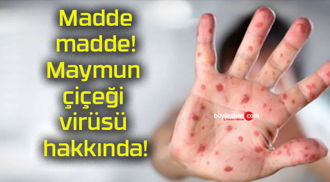 Madde madde! Maymun çiçeği virüsü hakkında!