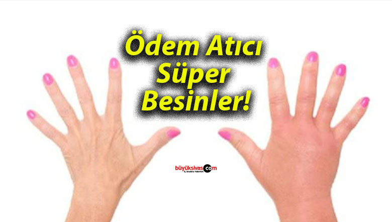 Ödem Atıcı Süper Besinler!