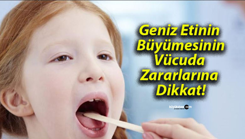 Geniz Etinin Büyümesinin Vücuda Zararlarına Dikkat!