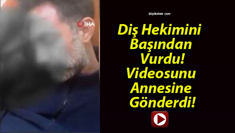 Diş Hekimini Başından Vurdu! Videosunu Annesine Gönderdi!