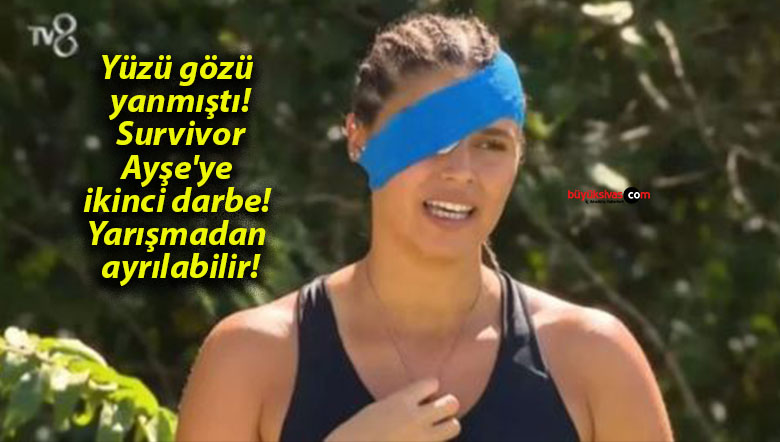 Yüzü gözü yanmıştı! Survivor Ayşe’ye ikinci darbe! Yarışmadan ayrılabilir!