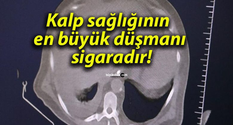Kalp sağlığının en büyük düşmanı sigaradır!