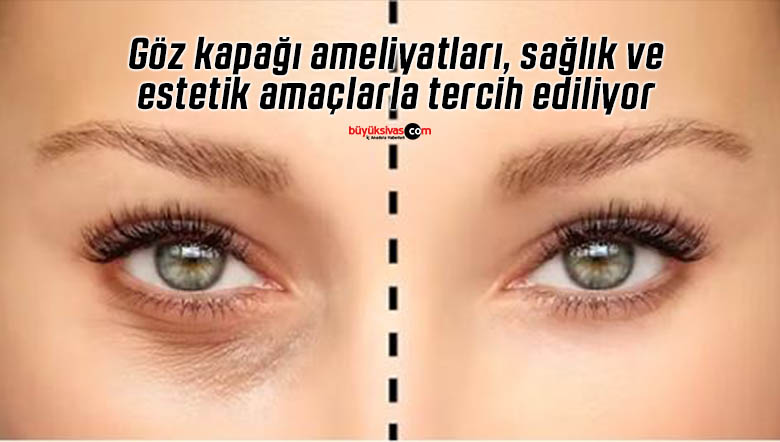göz kapağı