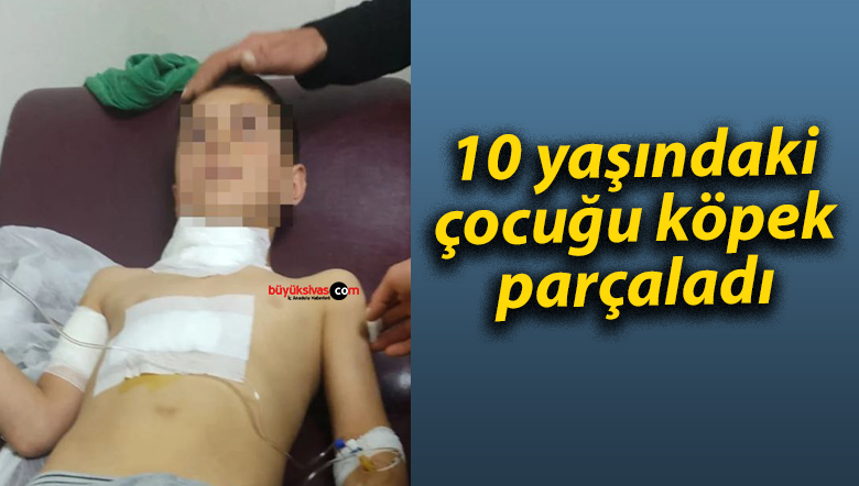 10 yaşındaki çocuğu köpek parçaladı